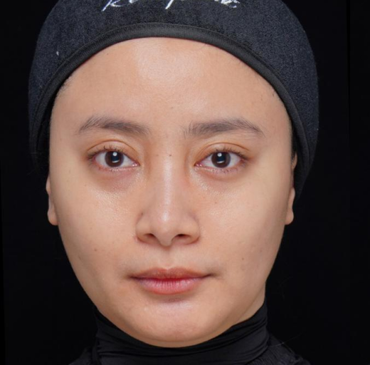 Before/After Image
